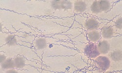 Borrelia burgdorferi